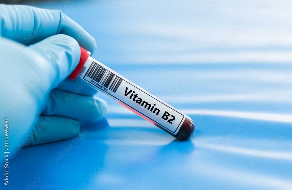 Obraz premium Blood sample tube for vitamin B2 test analysis.