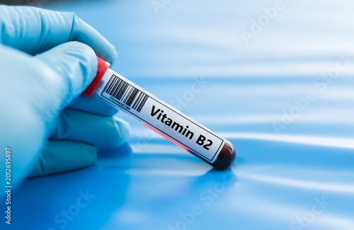 Obraz na plátně Blood sample tube for vitamin B2 test analysis.