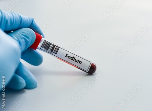 Photos Blood sample tube for sodium test analysis.