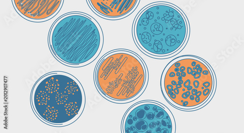 An illustration of various petri dishes containing different colored microbial cultures and biological samples, arranged on a light background.
