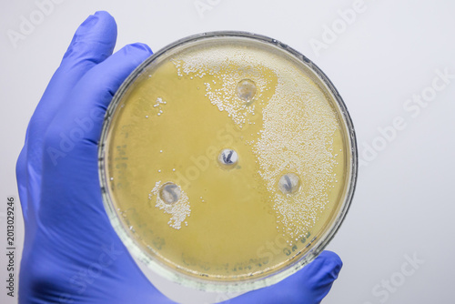 Foto A Petri dish with holes for liquid antibiotics and white colonies of actinobacteria on a nutrient medium