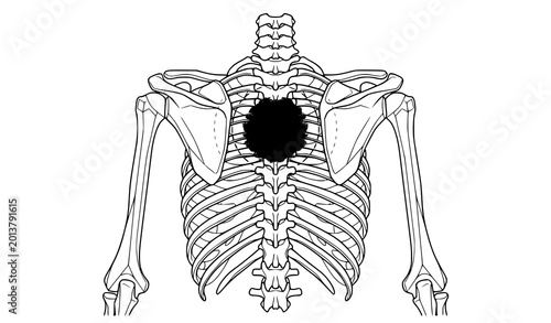 Photos Upper torso skeletal structure with spinal injury and back pain medical vector i
