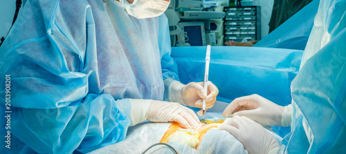 Professional surgeon in sterile gloves using a medical marker to draw preoperative skin incision lines on a patient in the operating room.