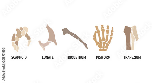 Bild auf Leinwand Anatomical Illustration of Human Wrist Bones: Scaphoid, Lunate, Triquetrum, Pisi