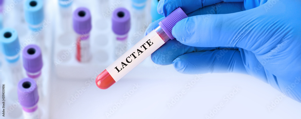 Naklejka premium Doctor holding blood sample tube with lactate test in modern medical laboratory, biochemical blood analysis concept for diagnostics of metabolism, hypoxia, acidosis and emergency healthcare monitoring