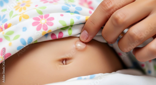 Close up of baby abdomen with blister being touched by adult finger skin