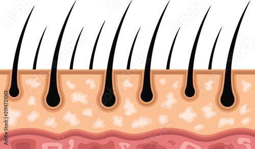 Fotografie Cross-section of human skin showing hair follicles and hair shafts
