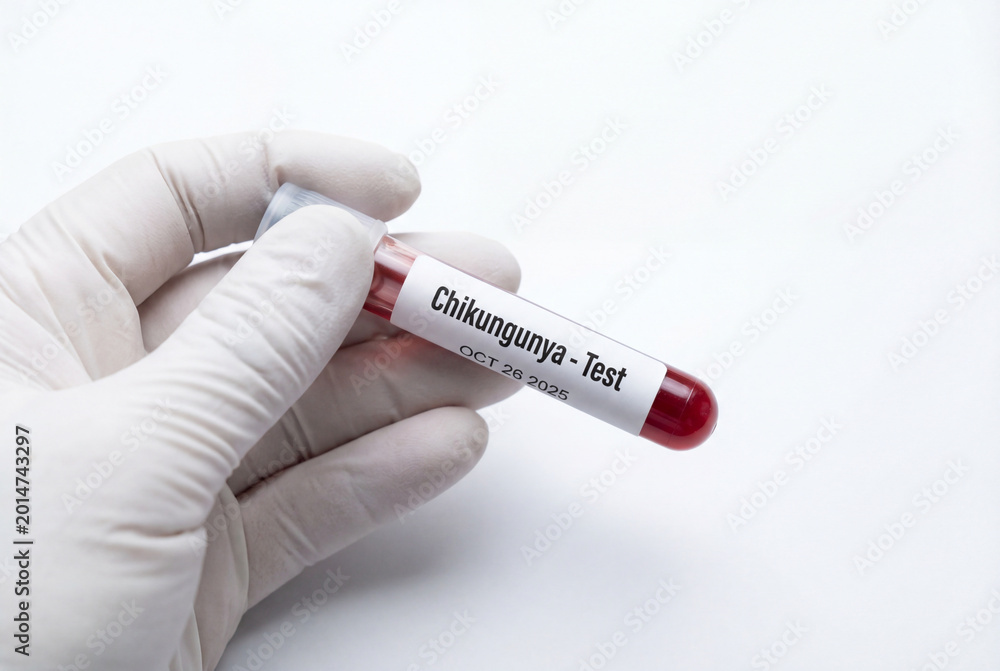 Naklejka premium Gloved hand holding blood sample tube for chikungunya test