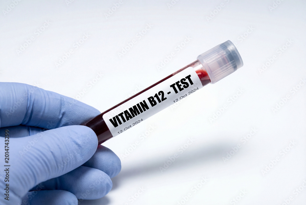 Fototapeta premium Gloved hand holding blood sample tube for vitamin b12 test