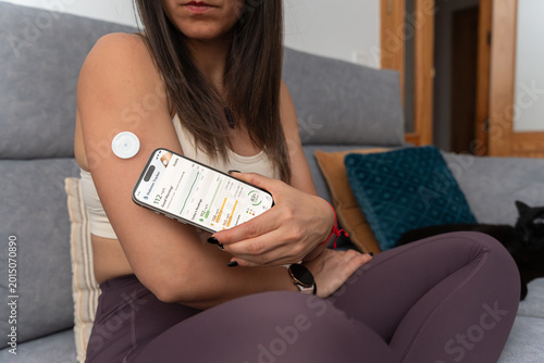 Continuous glucose monitoring using smartphone for diabetes management