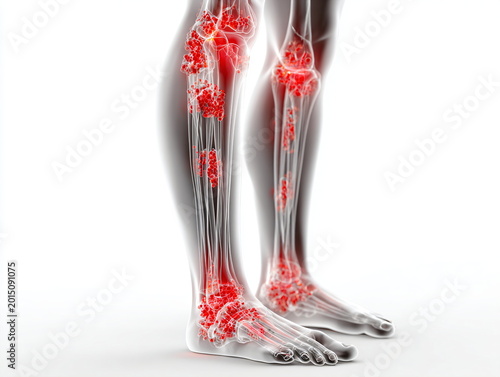 3D Medical Illustration of Lower Leg and Foot Pain with Glowing Inflammation Points