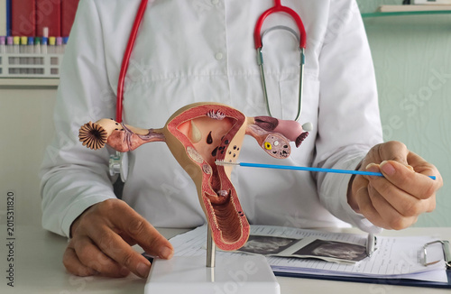Analysis of a human uterus and cervix model. Cytogram and cytological examination of cervical scrapings
