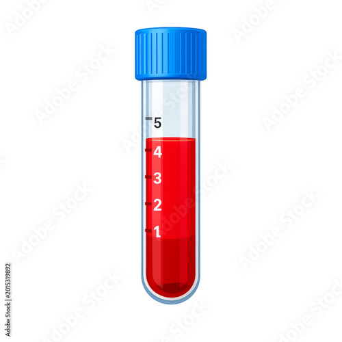 Blood sample in test tube for medical laboratory analysis