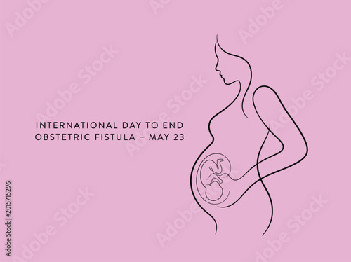 Fotografie international day to end obstetric fistula