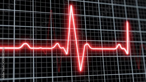 Medical illustration of a red heartbeat line on a black grid background