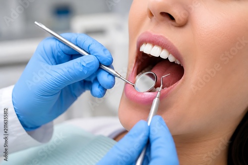 Close-up of dentist hands in blue gloves examining female patient teeth with mirror and probe in dental clinic, oral hygiene and teeth care concept.