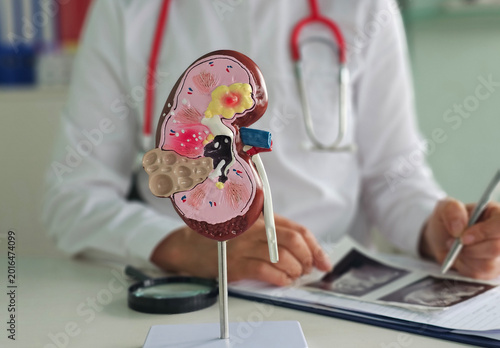 Konstfotografi Doctor urologist holds model of kidney concept