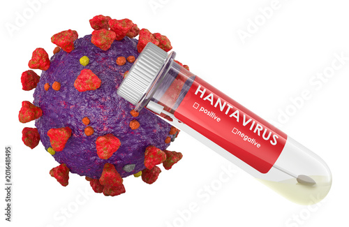 Test tube with hantavirus virus particle for hantavirus diagnosis, 3d rendering