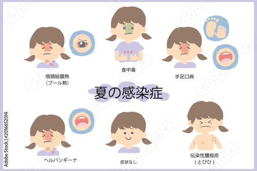 夏の感染症 イラストセット 手足口病 ヘルパンギーナ プール熱 とびひ 食中毒 子供 症状 幼稚園 保育園 小児科 保健だより 素材