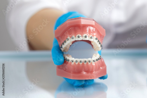 Принти на полотні Doctor orthodontist showing model of human jaw with wire braces attached