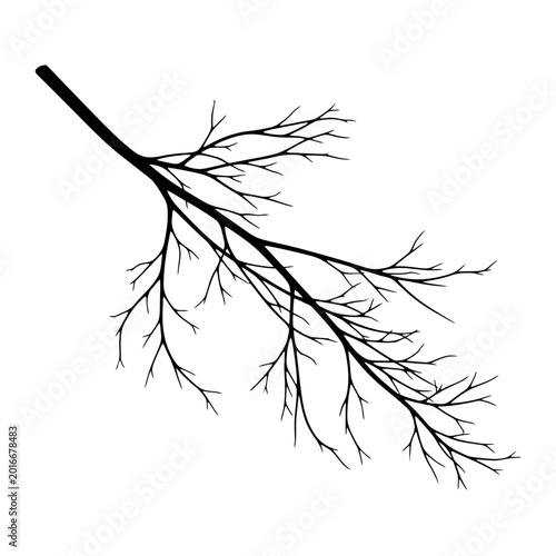 Tableau sur toile Detailed view of bronchial tree structure.