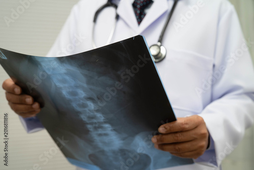 Quadro su tela Doctor examining spine bone radiography xray film.
