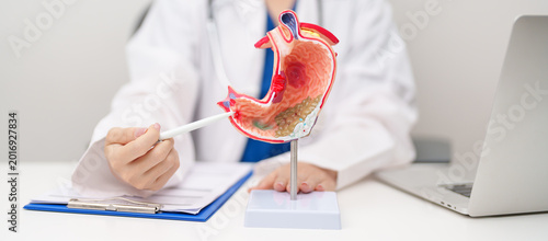 Cuadro en lienzo Doctor with Gastric anatomy model
