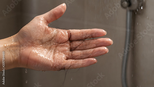Hair loss, Fallen hair, Hair strands, Wet palm, Wet hand, Hair fall, Showering