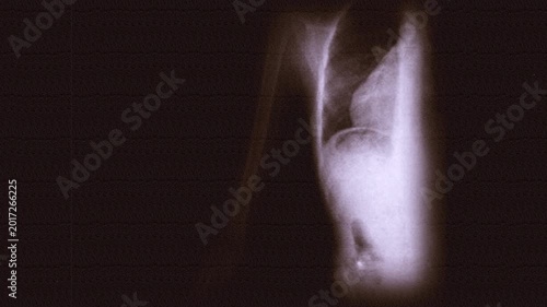 Vintage 1930s Fluorography Footage – Rapid X-Ray Sequence on Scratched 35mm Sepia Film