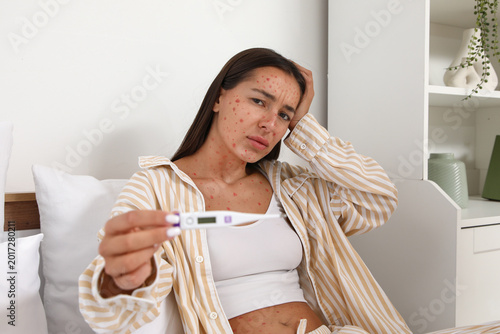 Фотография Young woman ill with chickenpox and thermometer in bedroom