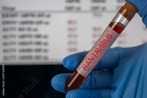hantavirus test tube blood sample hand blue glove cruise ship background sea water medical diagnostics infection control laboratory analysis with copy space, medicine, epidemiology