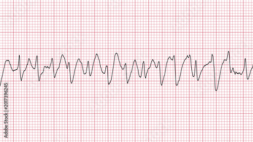 Foto Clinical Heart Rate ECG Monitor Medical Illustration Graphic Design Element