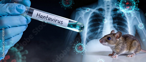 Hantavirus outbreak. Test tube with rodent, virus particles and human lungs X-ray pulmonary syndrome background image, copy space