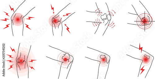 Foto Knee Pain Icon Set Featuring Various Pain Indicators, Redness, and Swelling for