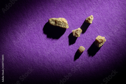 Kidney Stones