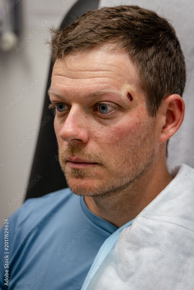 Obraz premium Local Anesthesia Injection Before Mohs Surgery Basal Cell Carcinoma