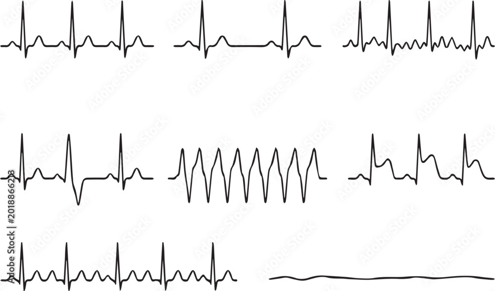 Obraz premium Multiple ecg heartbeat tracings on a medical chart with varying rhythms and patterns
