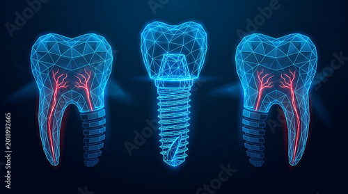 Futuristic dental implant technology showing digital wireframe teeth with glowing nerves on dark blue background