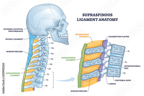 Konstfotografi Supraspinous ligament anatomy brief depicts the ligament running along spinous processes, clarifying spinal support with vertebral bodies and discs as context