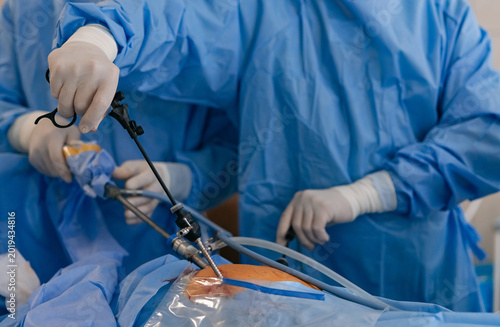 фотографія Surgeons performing laparoscopic abdominal surgery with endoscopic tools