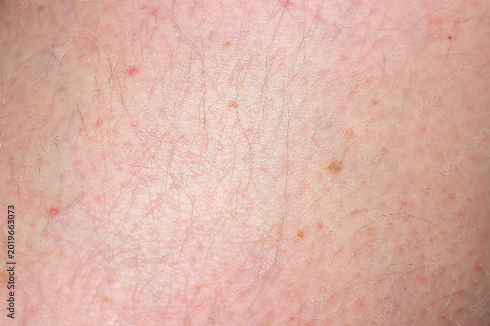 Fototapeta premium Close-up macro view of human skin texture with fine hairs and small blemishes