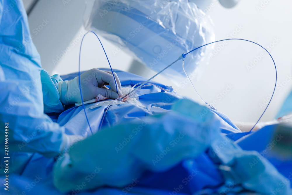 Fototapeta premium Cardiac catheterization procedure with surgeon hands using catheters and guidewires in sterile operating room for interventional cardiology clinical