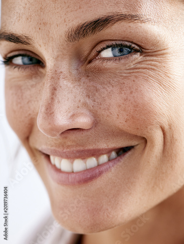 Happy woman with freckles and blue eyes showing natural and radiant smile.