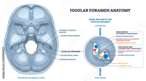 Photos Jugular foramen anatomy shows skull base passage, internal jugular vein, glossopharyngeal and vagus nerves clarify pars nervosa vs vascularis compartments