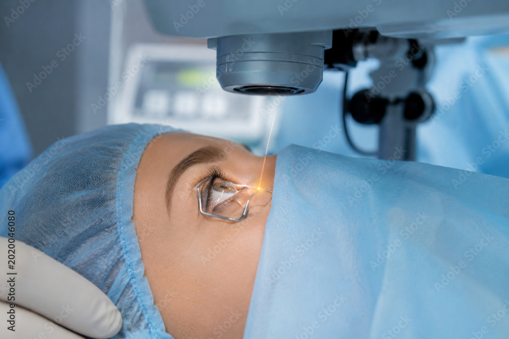 Carta da parati Close-up of modern eye surgery for cataract removal or laser vision correction
