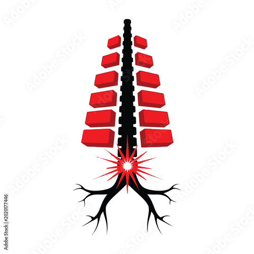 Bild auf Leinwand Human Spine Anatomy with Lower Back Pain Inflammation Concept Showing Degenerati