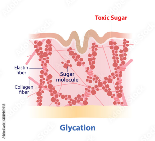 The mechanism of glycation skin layer illustration on white background. When sugar molecules bind to protein fibers, collagen and elastin to become brittle, less elastic which cause the skin to age.