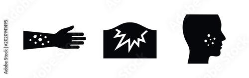 Fényképezés Set of black icons representing common skin conditions: rash on an arm, skin inflammation or pain, and acne on a face