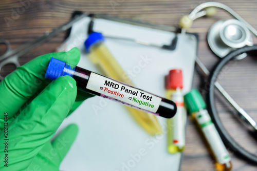 MRD panel Test with blood sample in green gloved hands. For diagnostic tool used to detect and monitor cancer cells
