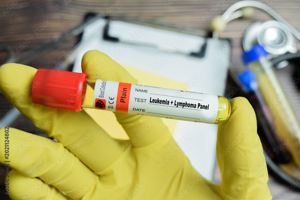 Obraz premium Leukemia and lymphoma panel Test with blood sample in yellow gloved hands.
